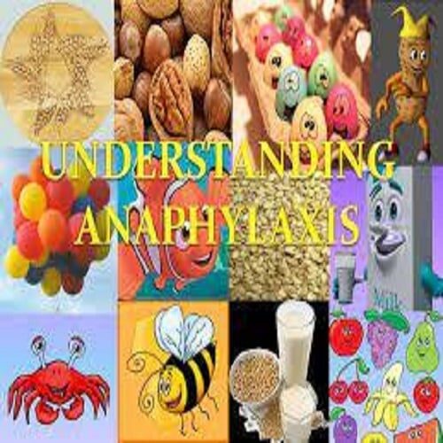 Understanding Anaphylaxis