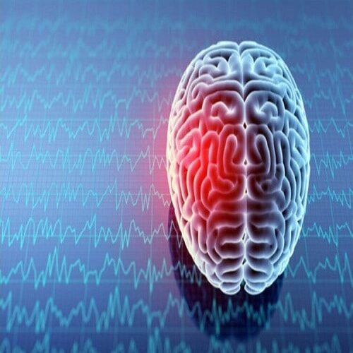 Concussion Awareness Training Course