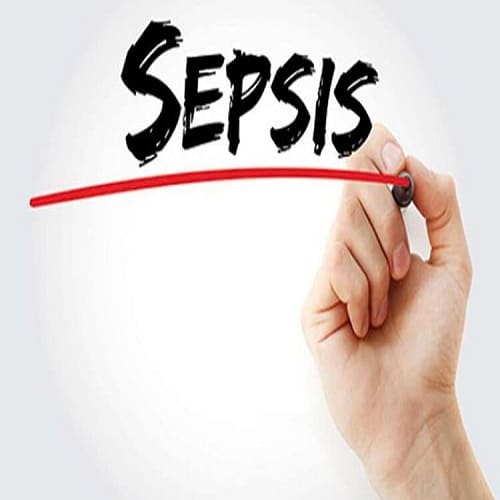 Introduction to Sepsis